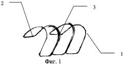 Способ трансплантации трахеи тонкой кишкой (патент 2306877)