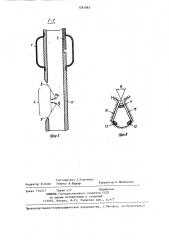 Интубационная трубка (патент 1287885)