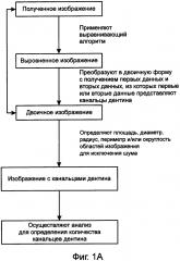 Обработка изображения канальцев дентина (патент 2635290)