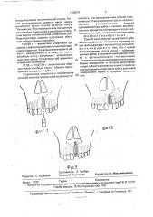 Способ изготовления штифтового зуба (патент 1799575)