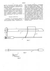 Устройство для исследования уретры и тканей полового члена (патент 1602444)