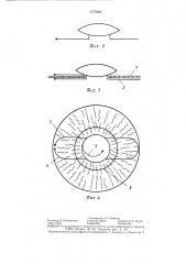 Искусственный хрусталик глаза (патент 1377084)