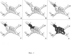 Способ эмболизации церебральных артериовенозных мальформаций (патент 2497457)