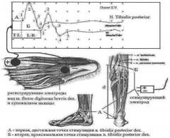 Способ оценки комфортности адаптационной одежды (патент 2402250)