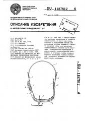 Аппарат п.е.збрицкого для формирования окклюзионной плоскости (патент 1187812)