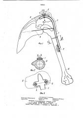 Устройство для компрессионного артродеза плечевого сустава (патент 906551)