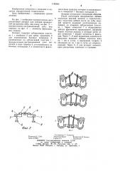 Компрессионно-дистракционный аппарат для лечения врожденной расщелины неба (патент 1183093)
