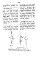 Шайба к винту для остеосинтеза (патент 1498480)