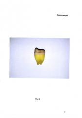 Композиция для профилактической гигиены и чистки зубов (патент 2588970)