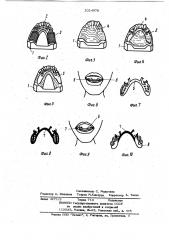 Способ изготовления съемных зубных протезов (патент 1024078)