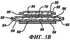 Составная гигиеническая прокладка (варианты) (патент 2253426)
