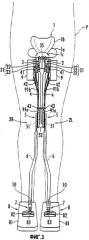Устройство, облегчающее ходьбу (патент 2389469)