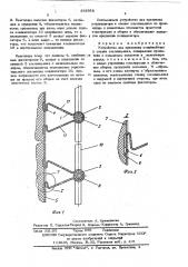 Устройство для крепления конденсатора к стенка холодильника (патент 578765)