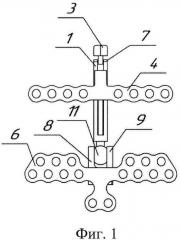Дистракционный аппарат (патент 2597281)