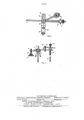 Устройство для репозиции и фиксации отломков костей нижней челюсти (патент 772536)