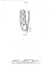 Тампон (патент 1599027)