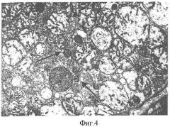 Способ оценки степени тканевой адаптации к функциональной недостаточности органов и систем с помощью определения феномена компенсаторной пролиферации митохондрий в клетках соответствующих тканей (патент 2357247)