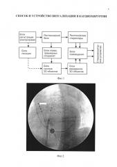 Способ и устройство визуализации в кардиохирургии (патент 2607948)