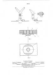 Устройство для определения перемещений костных отломков (патент 483110)