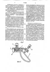 Устройство для лечения переломов и деформаций костей носа (патент 1718859)