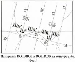 Способ измерения размеров зубов, зубных бугров и их внутренних и наружных скатов (патент 2438617)