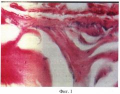 Способ изменения структуры костной ткани при экспериментальном стероидном остеопорозе (патент 2371189)