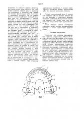 Устройство для лечения прогнатического прикуса (патент 1560175)