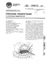 Способ лечения острого панкреатита (патент 1286175)