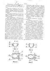 Устройство для массажа вымени коров (патент 694147)