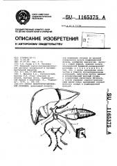 Способ панкреато-дуоденальной резекции (патент 1165375)