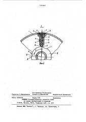 Устройство для измерения длины движущегося текстильного материала (патент 1151617)
