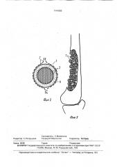 Средство для лечения остеомиелита (патент 1741805)