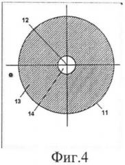 Способ хирургической коррекции пресбиопии в сочетании со сферической гиперметропией (патент 2514874)