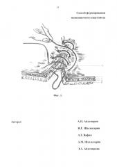 Способ формирования межкишечного анастомоза (патент 2663648)