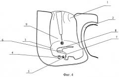 Способ профилактики вибротравмы внутреннего уха при удалении атрезии наружного слухового прохода (патент 2465875)