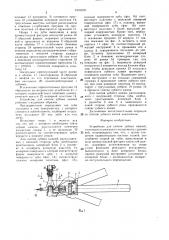 Устройство для снятия зубных камней и.г.мухина (патент 1516109)