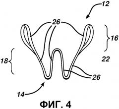Мягкое упругое внутривагинальное устройство для предотвращения недержания мочи (патент 2570772)