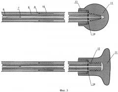 Термоэлектрическое устройство для локальной гипо- и гипертермии полости рта (патент 2355356)