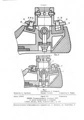 Искусственная стопа (патент 1424831)