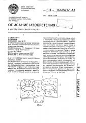Устройство для закрепления шовных нитей (патент 1669432)