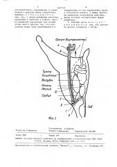 Рабочий орган для извлечения внутренностей из тушек птицы (патент 1637735)