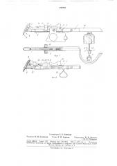 Хирургический аппарат для соединения тканей (патент 187218)