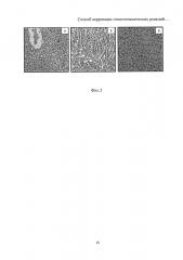 Способ коррекции гепатотоксических реакций, индуцированных изониазидом (патент 2601919)