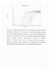 Способ диагностики тимомегалии у детей (патент 2611393)