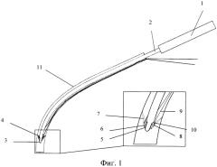 Устройство для фиксации имплантата в мягких тканях (патент 2580204)