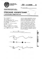 Способ определения сократительной функции миокарда (патент 1113089)