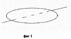 Способ ушивания ран при поперечной резекции печени и селезенки (патент 2283625)