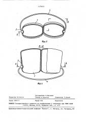 Зубной протез (патент 1475633)