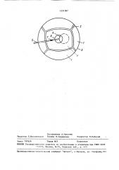 Датчик для регистрации статического тремора (патент 1531987)