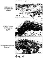 Лечение и/или предотвращение воспаления и фотоповреждения кожи и фотозащита кожи с помощью водорастворимого экстракта растения рода solanum (патент 2541804)